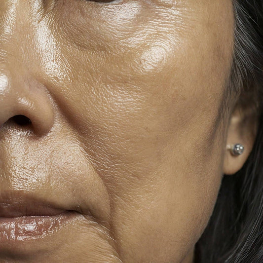 Menopausal Skin and the Skin's Microbiome