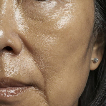 Menopausal Skin and the Skin's Microbiome