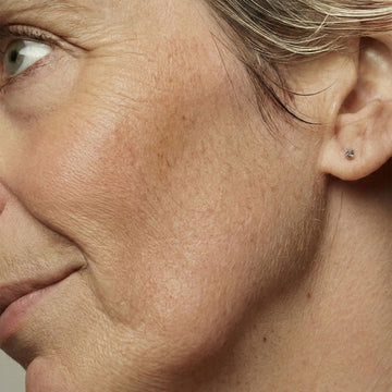 Dry Skin During Menopause: Causes & How to Support It