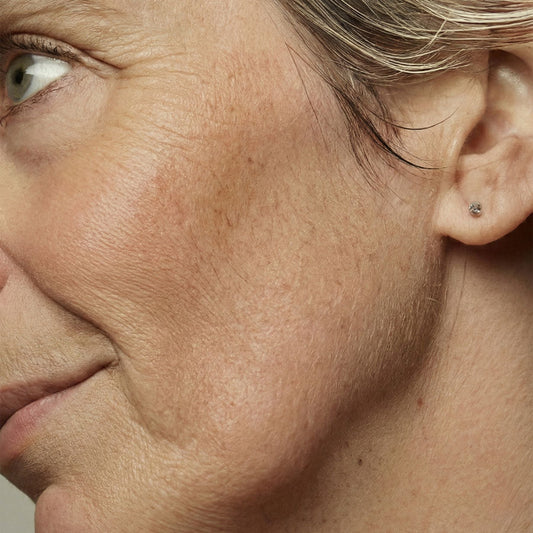 Dry Skin During Menopause: Causes & How to Support It