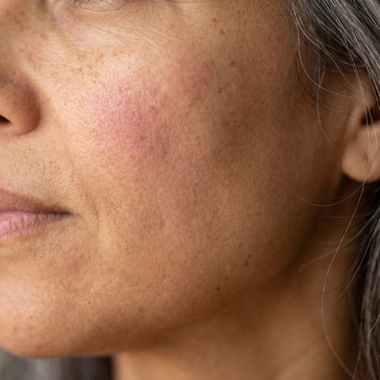 Why Your Skin Suddenly Reacts to Everything After 45