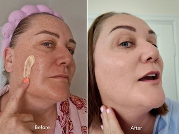 Before and after comparison of a woman applying Nu Allume Postbiotic Berry Night Moisturiser to her face.
