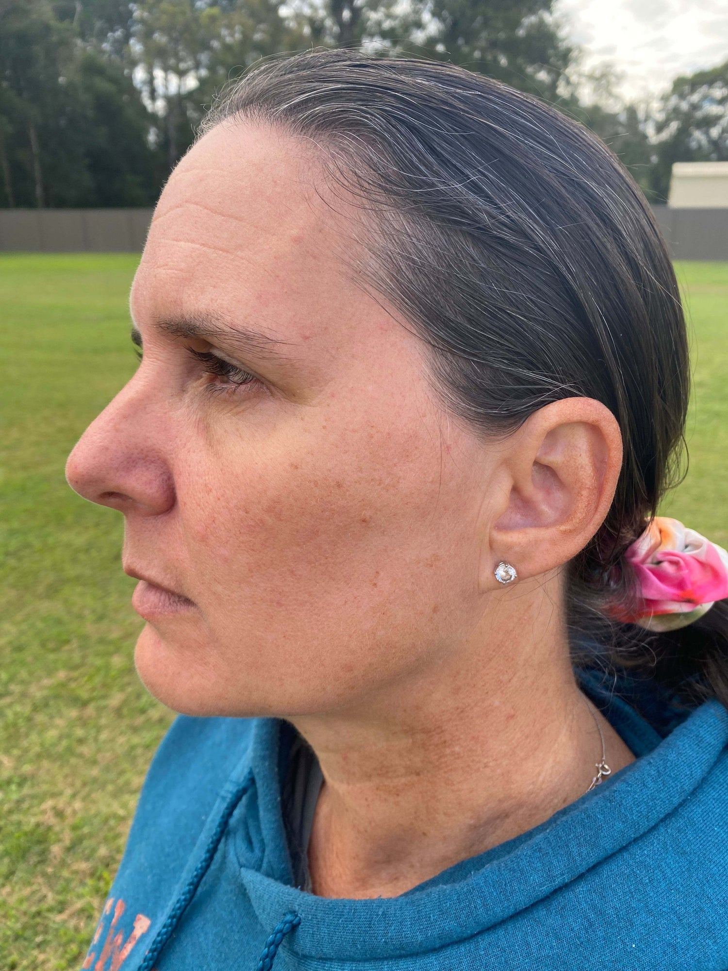 Desre 'after' photo of her face