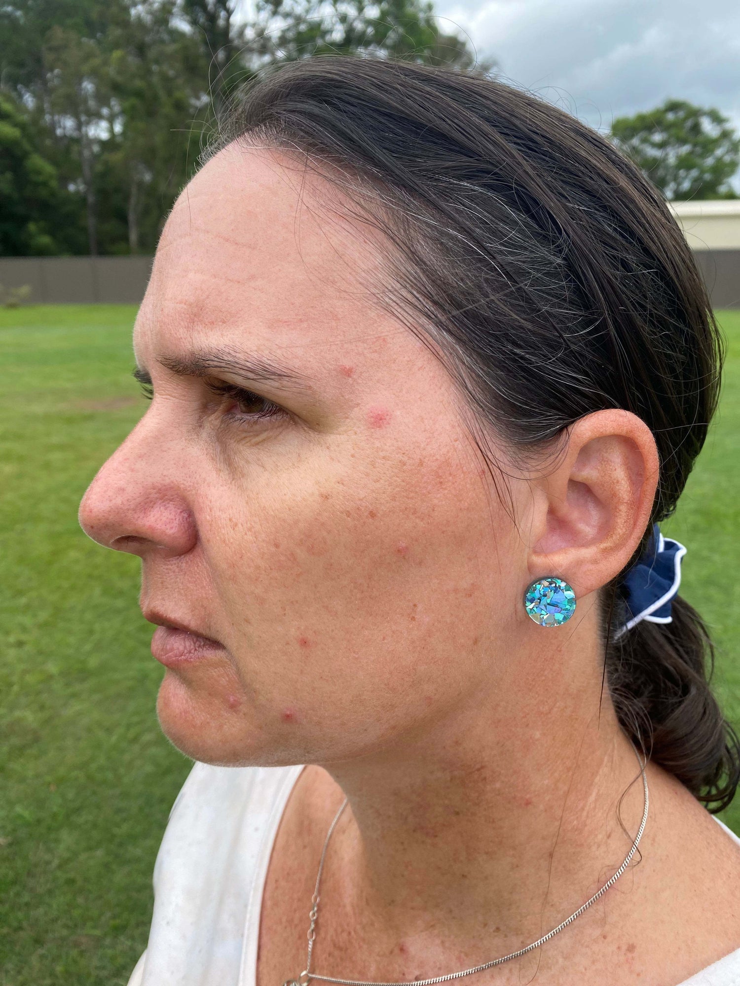 Desre 'before' photo of her face