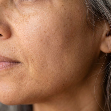 Close-up of a woman's face with visible skin texture